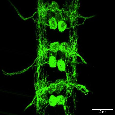 nerve cord