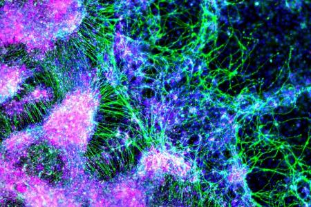 neural crest cells and sensory neurons